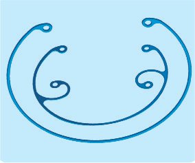 PMMA Capsular Tension Ring